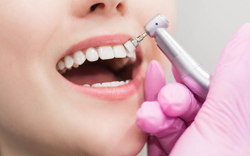How to restart dental cleanings