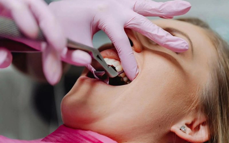 recovery after tooth extraction